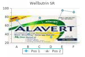 generic 150 mg wellbutrin sr mastercard
