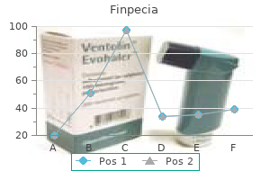 cheap finpecia 1 mg line
