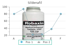 sildenafil 75 mg on line