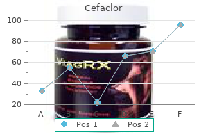 cheap cefaclor 500 mg buy on line